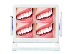 cámara dental intraoral de estilo wifi con 1 o 4 pantallas