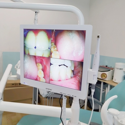 Wifi todo en una cámara oral con altavoz pantalla LCD escáner de cámara oral dental