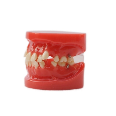 Formación Uso de los dientes dentales Modelo de enseñanza Funcional Modelo de ortodoncia dental sin soporte