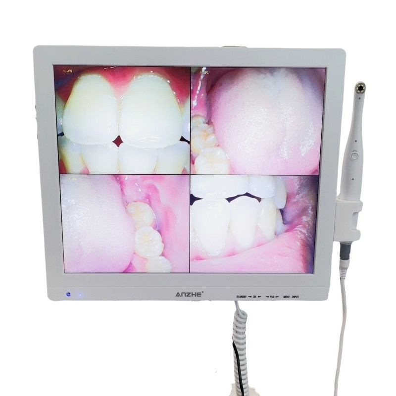 Wifi todo en una cámara oral con altavoz pantalla LCD escáner de cámara oral dental