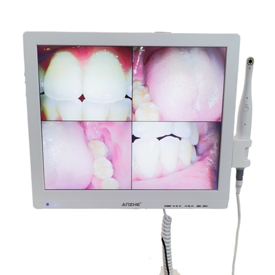 Wifi todo en una cámara oral con altavoz pantalla LCD escáner de cámara oral dental