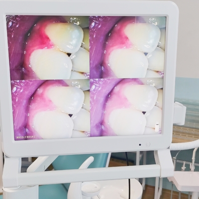 Endoscopio dental con monitor de 17 pulgadas Wifi cámara dental portátil portátil endoscopio intraoral cámara intraoral